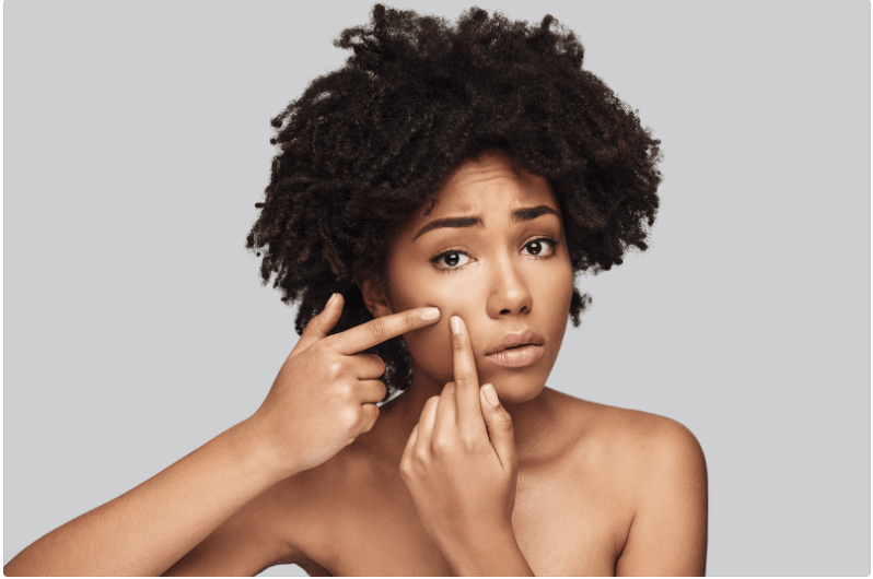 Got Maskne? Top 3 Ways to Reduce Your Mask&nbsp;Acne